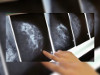 2 500 оттенков серого – в Челябинске появился маммограф, не имеющий аналогов в России