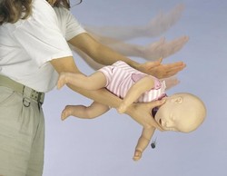 Инородные тела дыхательных путей у детей