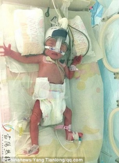 Жительница Китая дважды родила за семь дней. Фото