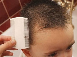 Детские волосы поражает неизлечимый педикулез