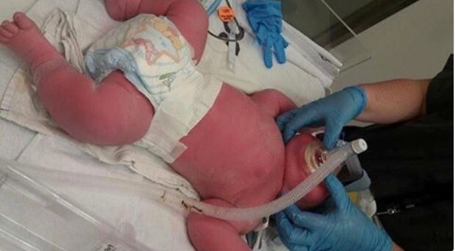 В Новой Зеландии родился 7-килограммовый мальчик